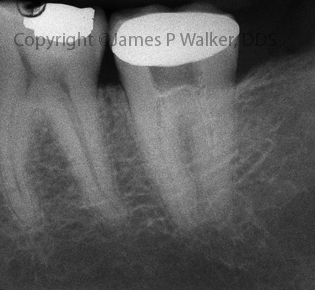 Molar